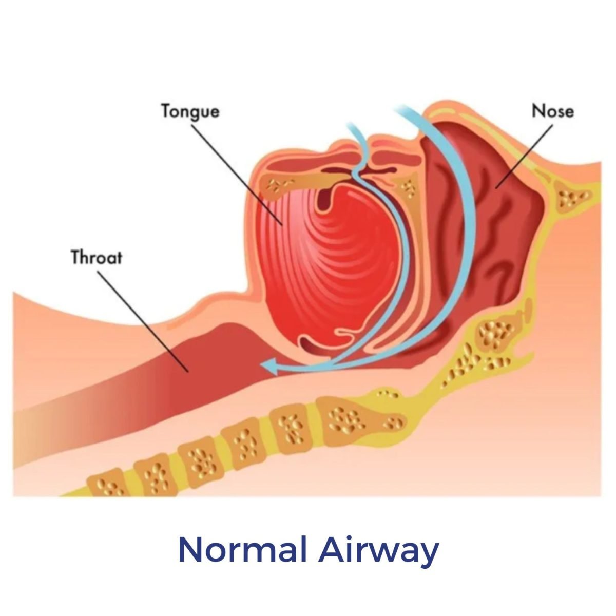 Normal airway diagram | Intus Healthcare